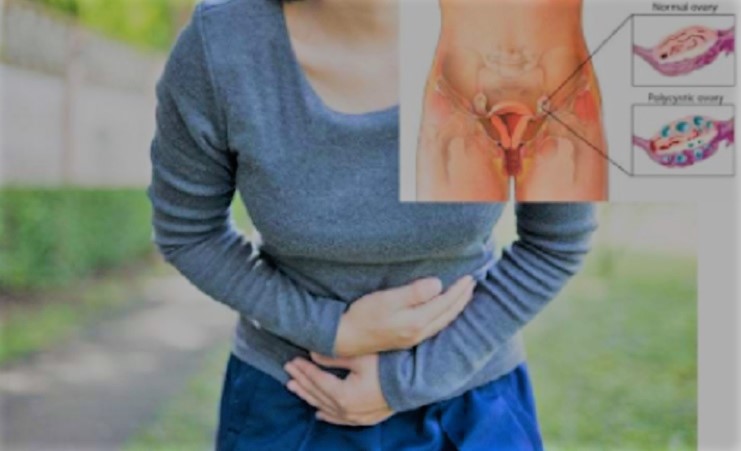 SAJAHEBOH.COM - Tanda-tanda Kanser Ovari, Sila Hati-hati Dan Rawat Sebelum Terlambat