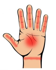 SAJAHEBOH.COM - Ketahui Petanda Penyakit Melalui Telapak Tangan Yang Boleh Kita Tahu