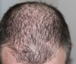 SAJAHEBOH.COM - Petua Melebatkan Rambut Nipis, Gunakan Cara Ini