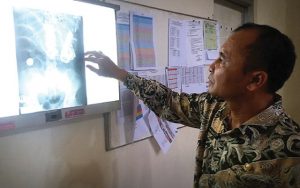 SAJAHEBOH.COM - Doktor Tergaman Bila Jumpa Sudu Besi,Garpu, Pemetik Api, Duit, Paku, Dan Pelbagai Lagi Barang Berbahaya Dalam Perut Seorang Lelaki