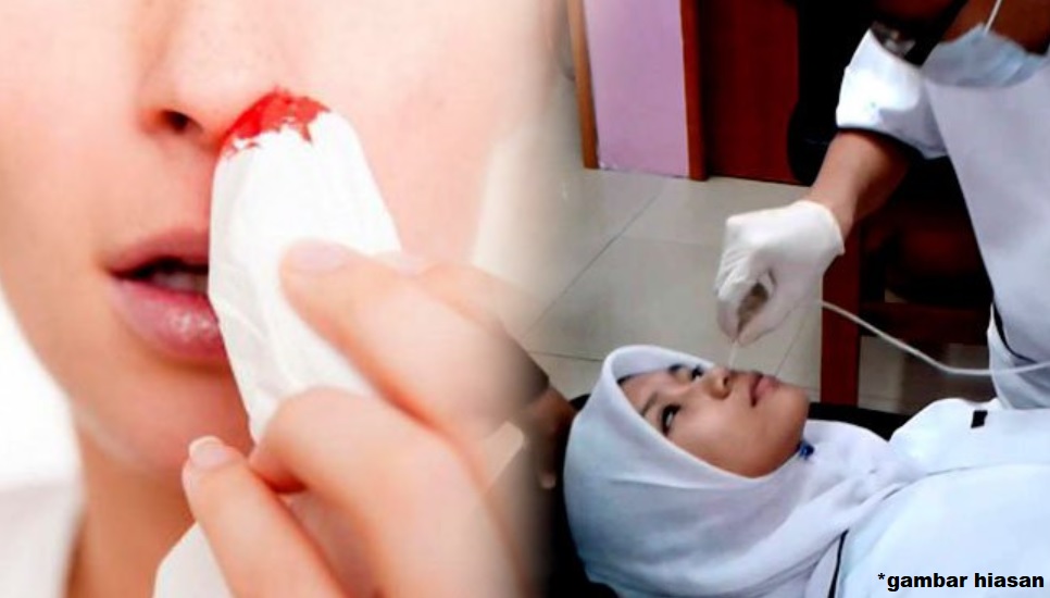 SAJAHEBOH.COM - Masalah Hidung Selalu Tersumbat Mungkin Petanda Kanser Pangkal Hidung