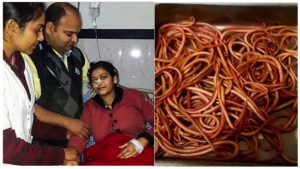 sajaheboh.com - Gadis Sakit Perut Dan Muntah-muntah, Doktor Terkejut Menemui 150 Cacing Ditemui Dalam Tubuhnya