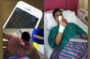 sajaheboh.com - Pemuda Nyaris Hilang Jari Gara-gara Tak Ganti ‘Screen Protector’ Handphone Yang Sudah Retak